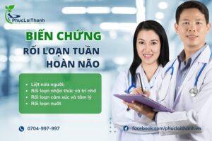 Các biến chứng của rối loạn tuần hoàn não đều vô cùng nguy hiểm