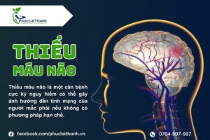 Thiếu máu não