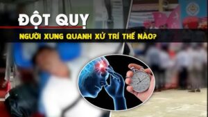 cách sơ cứu đột quỵ