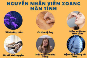 cách trị viêm xoang mãn tính