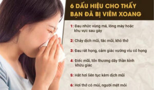 dấu hiệu của viêm xoang