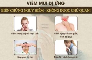 viêm mũi dị ứng thời tiết