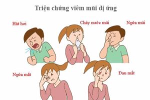 viêm mũi dị ứng thời tiết