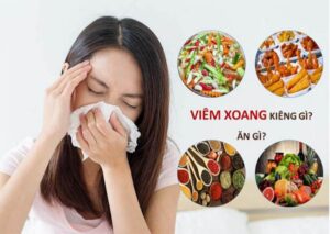 viêm xoang kiêng ăn gì